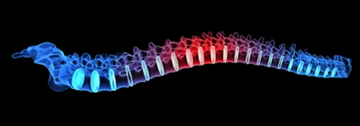 Medical illustration of a spinal column with red highlights along the midsection against a black background.